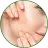 Promotes Skin Healing